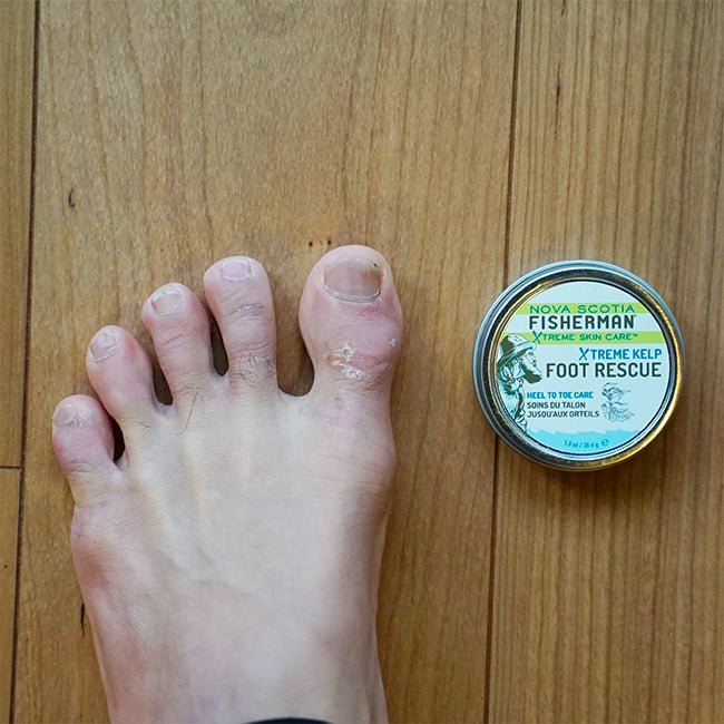 NOVA SCOTIA FISHERMAN FOOT RESCUE / ノバスコシアフィッシャーマン フットレスキュー